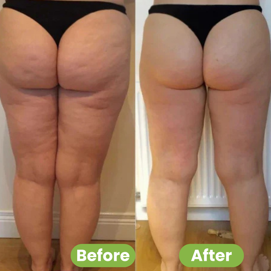 CelluSculpt™ Roller