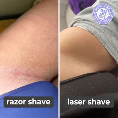 SILK SMOOTH™ - Laser Hair Remover (65% OFF TODAY ONLY!)